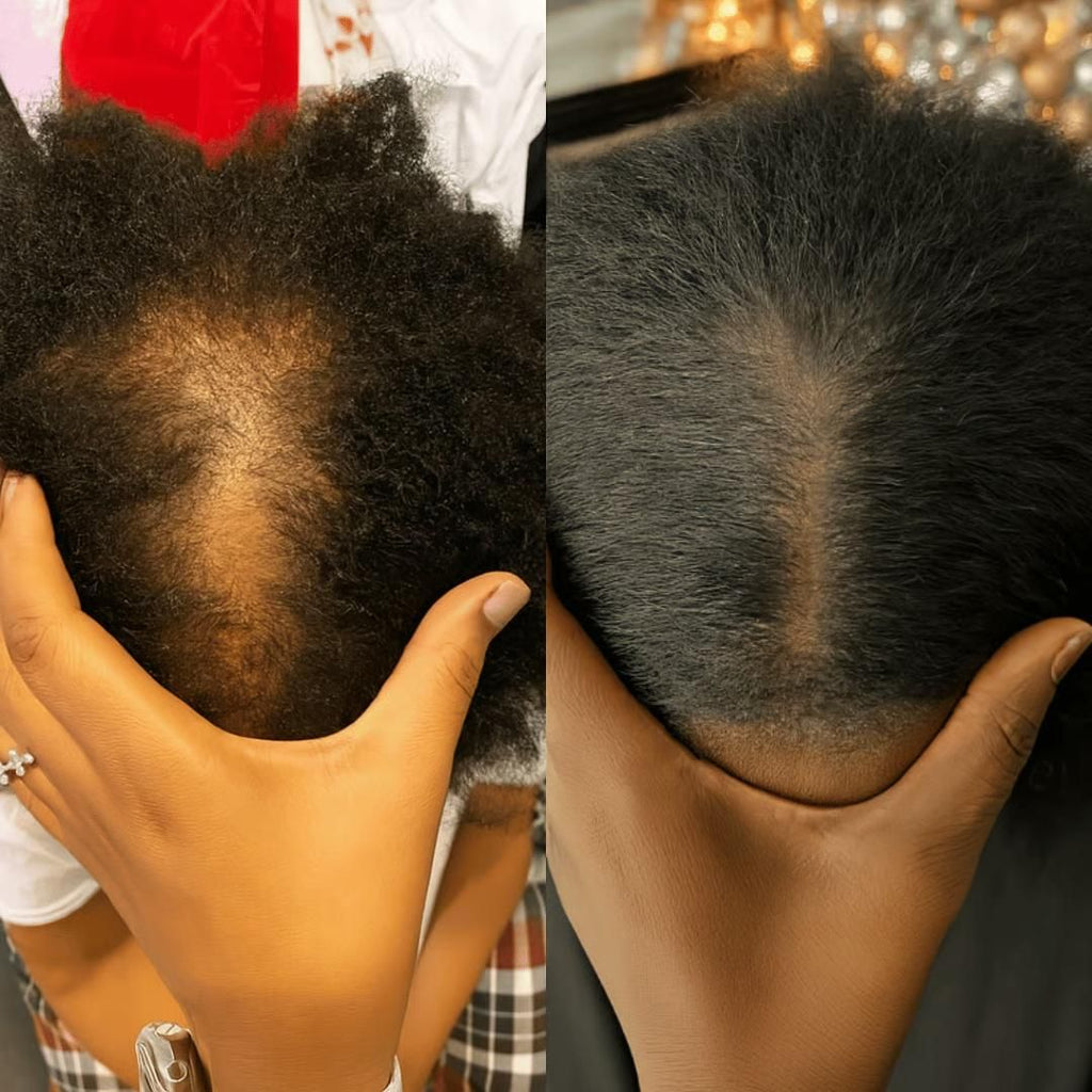 Sérum accélerateur de pousse cheveux afro